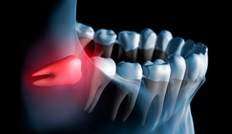 cirugiaoral1