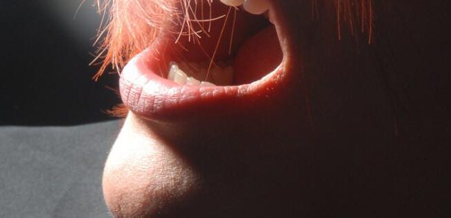 bad breath